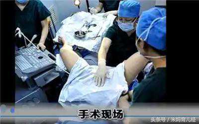 去香港验血要多少时间才知道结果,试管婴儿全过程（图解），看哭了，真的心