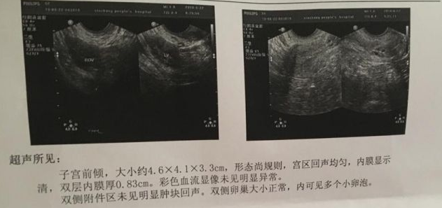 香港验血胎芽达到多长时间,人工试管双胞胎多少钱？试管做双胞胎效果