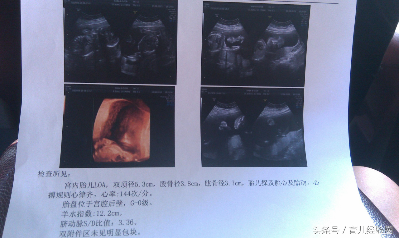 一年内怀孕 香港验血,梦美备孕指导：赴美试管婴儿前如何提高卵子质量？